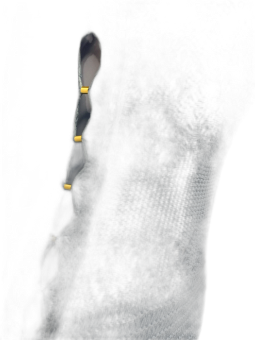 Alexis Size L Blue Cotton Open Knit Sleeveless Dress Blue / L